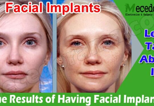 Complete Guide to The Results of Having Facial Implants