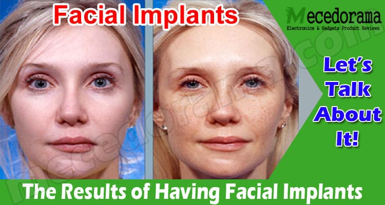 The Results of Having Facial Implants: Acquire Full Detail!
