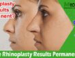 Complete Information Are Rhinoplasty Results Permanent